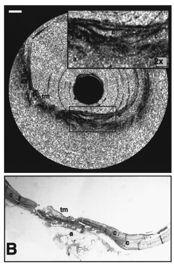 Tecnologia laser (3)