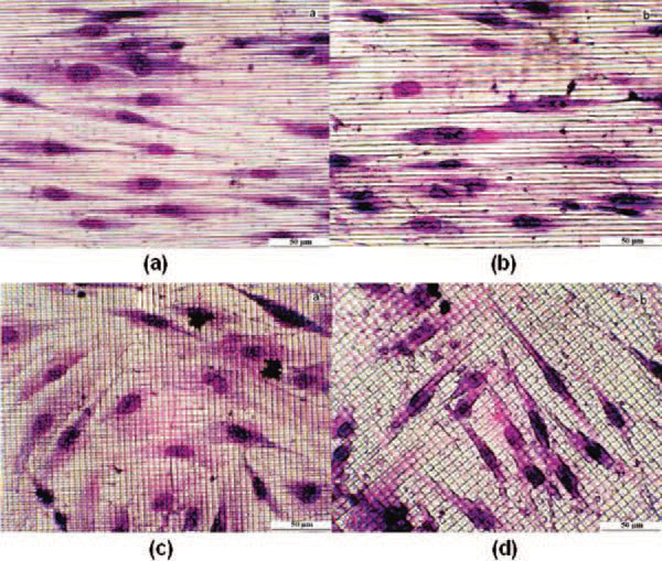 Applicazioni del laser (5)